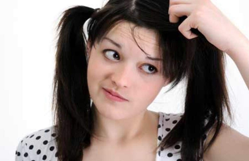 How to Get Rid of Dandruff?