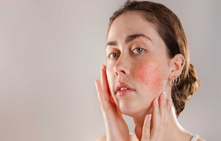 How Alcohol And Cutting Alcohol Affects Your Skin? | Thefitneshealth.com