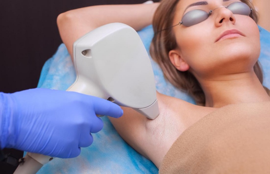 Laser Hair Removal Treatment- Why Men Should Consider