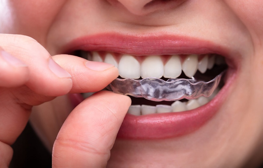 What happens if you grind your teeth too much?