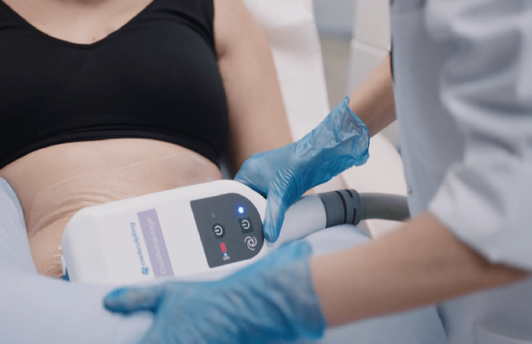 Understanding the CoolSculpting Procedure in NYC: What to Expect
