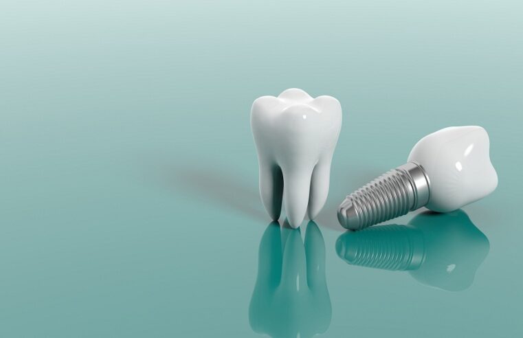 Why Are Dental Implants Expensive?