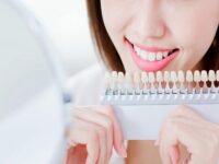 Whiten Dental Implants