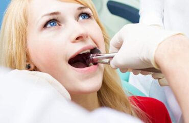 Wisdom Teeth Removal: What to Expect Before, During, and After