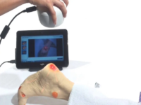 remote wound care
