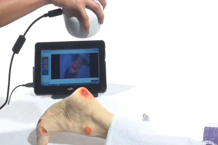 When Remote Wound Care Is Necessary