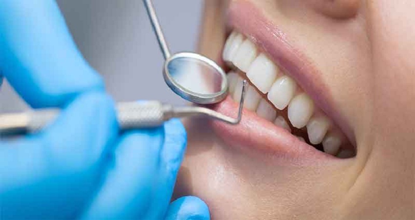A Clean Smile Can Still Hide Early Dental Issues Below the Surface