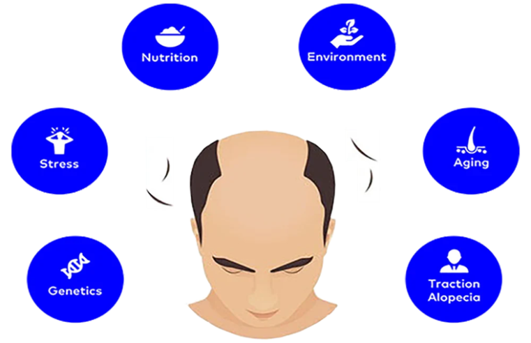 Hair Loss Treatment in Men: A Complete Guide to Types, Patterns, and What Actually Helps
