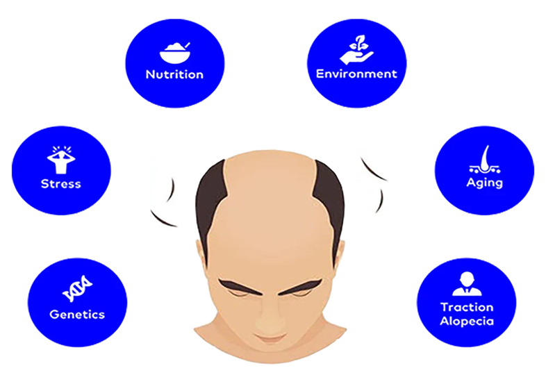 Hair Loss Treatment in Men: A Complete Guide to Types, Patterns, and What Actually Helps